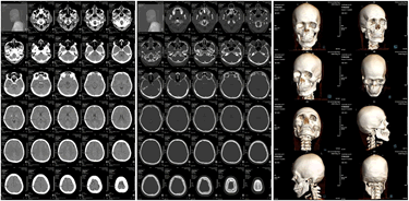 Journa-Drug-Alcohol-Research-CT Journa-Drug-Alcohol-Research-CT